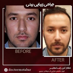 جراحی زیبایی مردانه