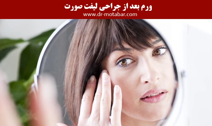 ورم بعد از جراحی لیفت صورت