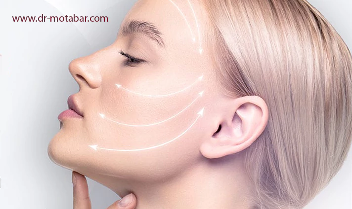 مزایای اندولیفت صورت