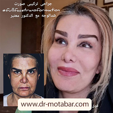 جراحی ترکیبی صورت