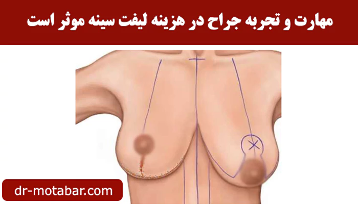 عوامل موثر در هزینه لیفت سینه